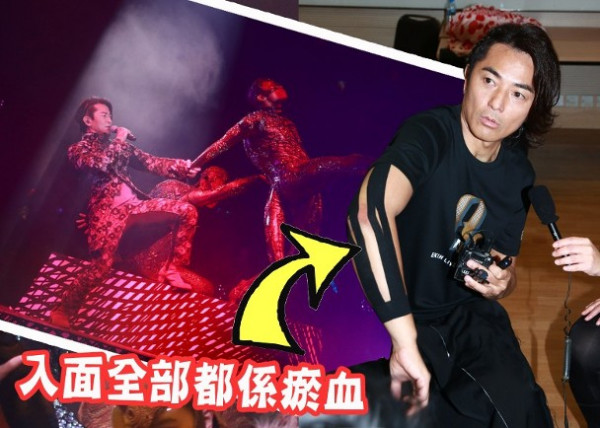 郑伊健演唱会半只脚踏空致右手韧带撕裂 自曝犹有馀悸